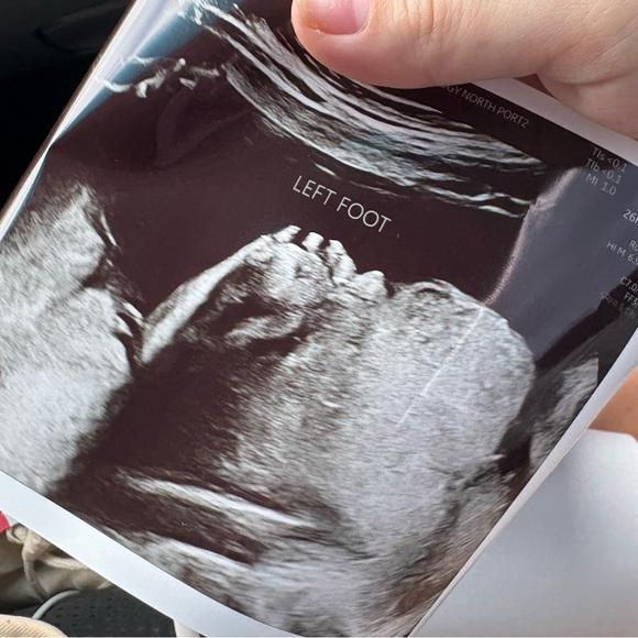 PURCHASE YOUR TICKET FOR DIAPERS & WIPES, GOODLUCK & TYSM ๐ผ๐ผ๐คฑ - Picture 12 of 14